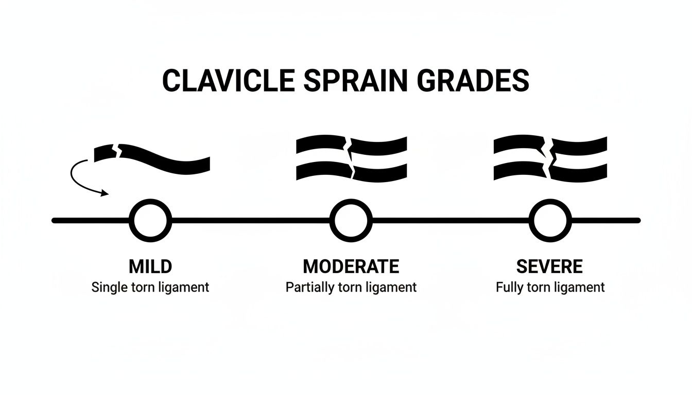 Infographic showing three grades of clavicle sprains: mild, moderate, and severe, based on ligament tears.
